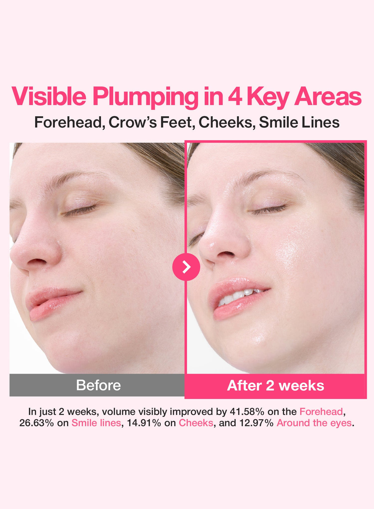 No.2 Rose PDRN Collagen Plumping Serum (30ml)