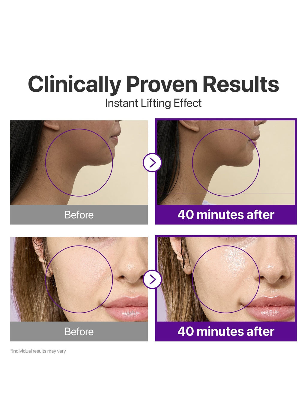 No. 9 NAD Bio Lifting-sil Full Face Pack Sheet (4ea+GWP) (20ml/28ml)