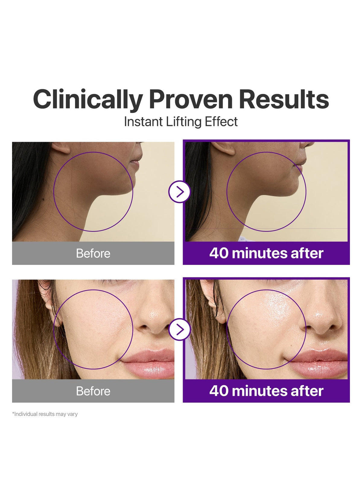 No. 9 NAD Bio Lifting-sil Full Face Pack Sheet (4ea+GWP) (20ml/28ml)