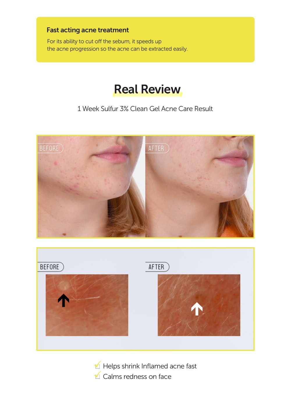 Sulfur 3% Clean Gel (30g)