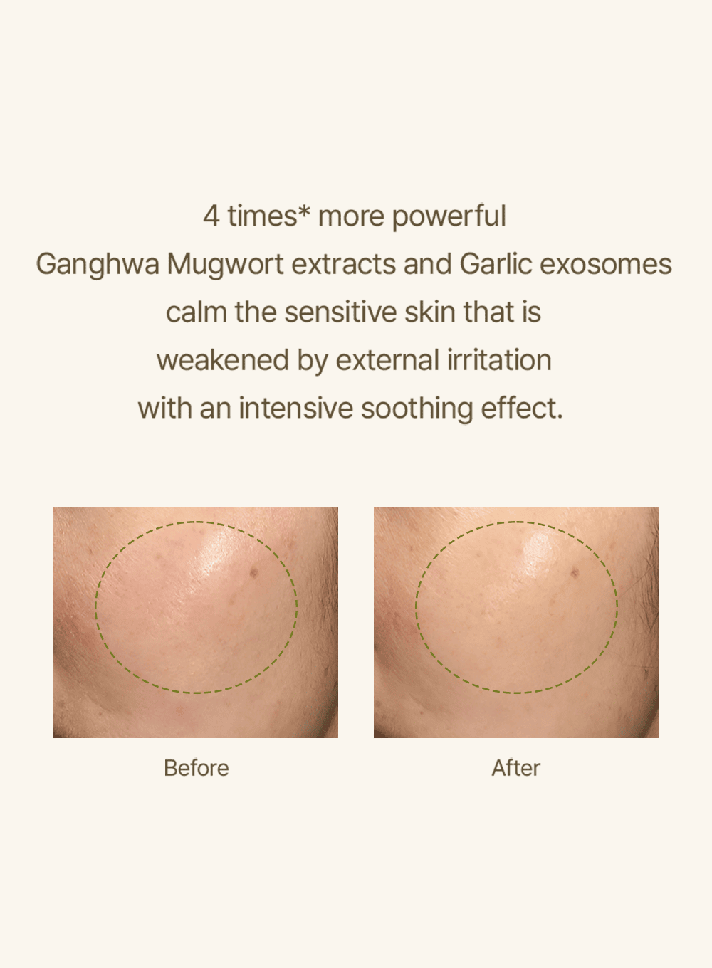 Mugwort Serum (30ml)
