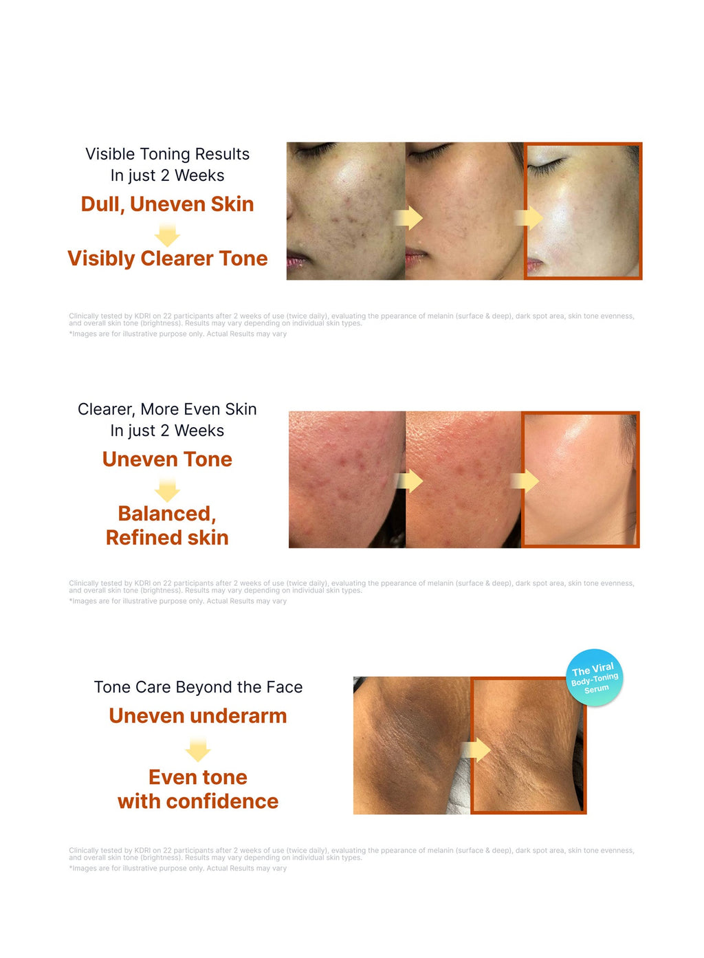 Kojic Acid Niacinamide Brightening Ampoule Trio Set (40ml*3ea)